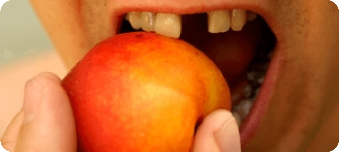 3D-imaAge-of-a-single-implant-in-lower-jawbone 2 (2)