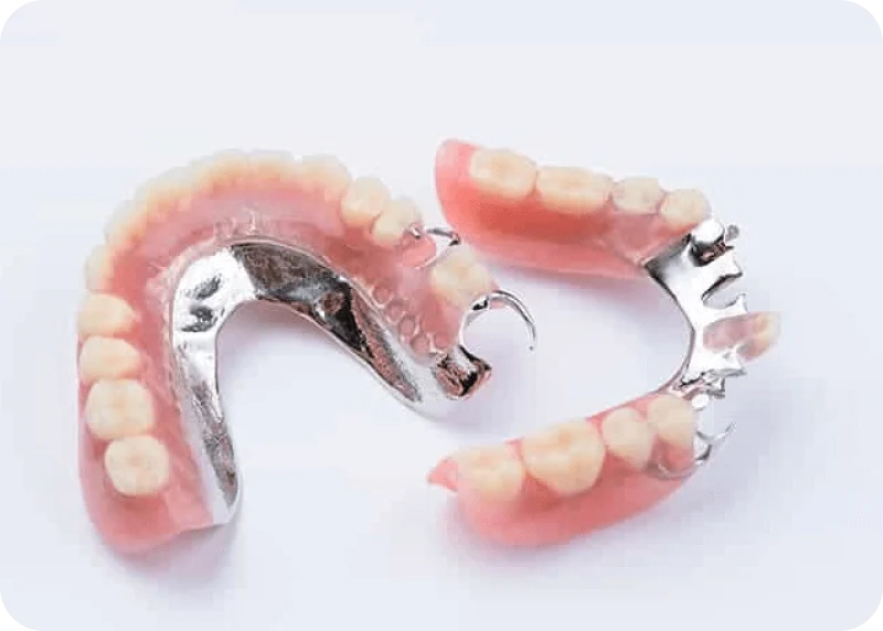 Pair of metal-framed partial dentures