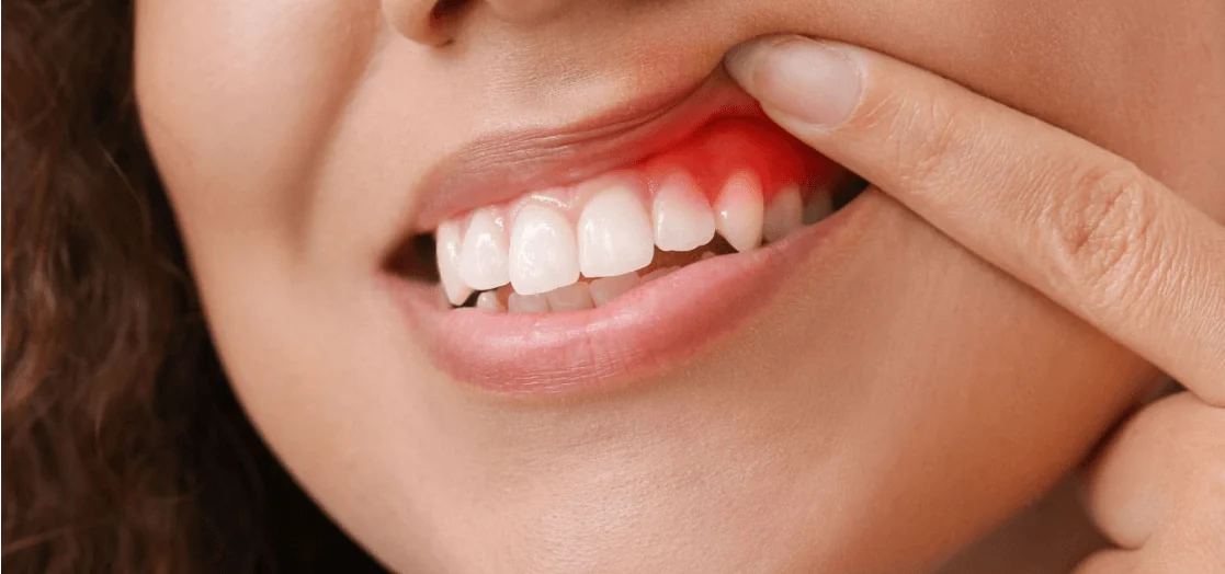 ozkan-guner-rOFbz74Ljro-unsplash 1