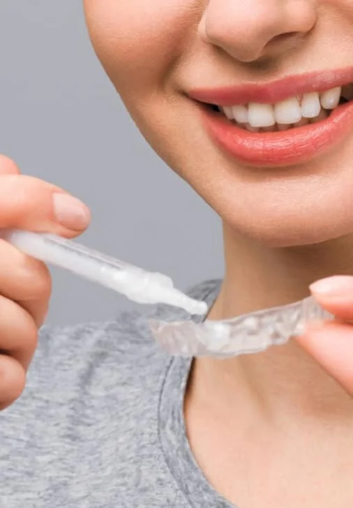 professional-whitening-section3-img (2) (1)
