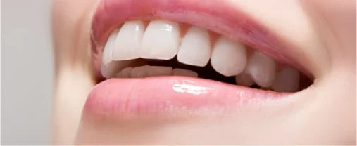 professional-whitening-section4-img