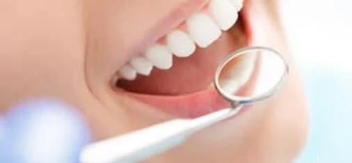 professional-whitening-section6-img (1)