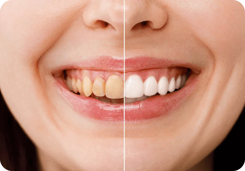 woman-getting-botox-injection-into-her-face 1